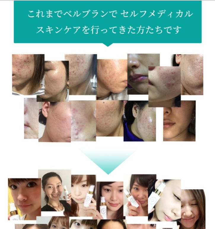 ベルブラン激安について